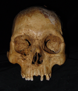 Skull from the Laguna Huayabamba